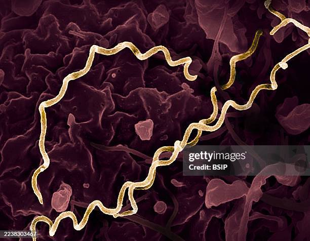 Colorized electron micrograph of Treponema pallidum, the bacteria that cause syphilis. Several spiral-shaped bacteria have been highlighted in gold.