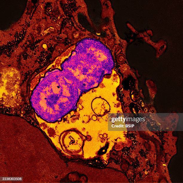 Human neutrophil containing ingested Klebsiella pneumoniae . NIH Investigates Multidrug-Resistant Bacterium Emerging in Community Settings.