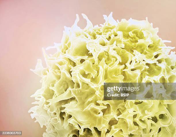Colorized scanning electron micrograph of a T lymphocyte .