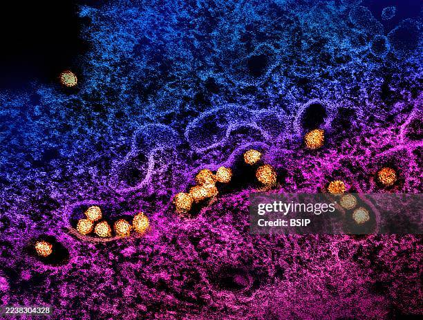 Transmission electron micrograph of West Nile virus particles replicating within the cytoplasm of an infected VERO E6 cell .