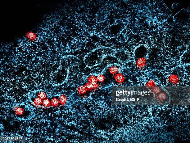 Transmission electron micrograph of West Nile virus particles replicating within the cytoplasm of an infected VERO E6 cell .