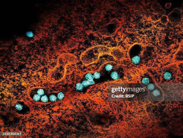 Transmission electron micrograph of West Nile virus particles replicating within the cytoplasm of an infected VERO E6 cell .