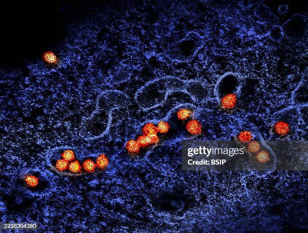Transmission electron micrograph of West Nile virus particles replicating within the cytoplasm of an infected VERO E6 cell .