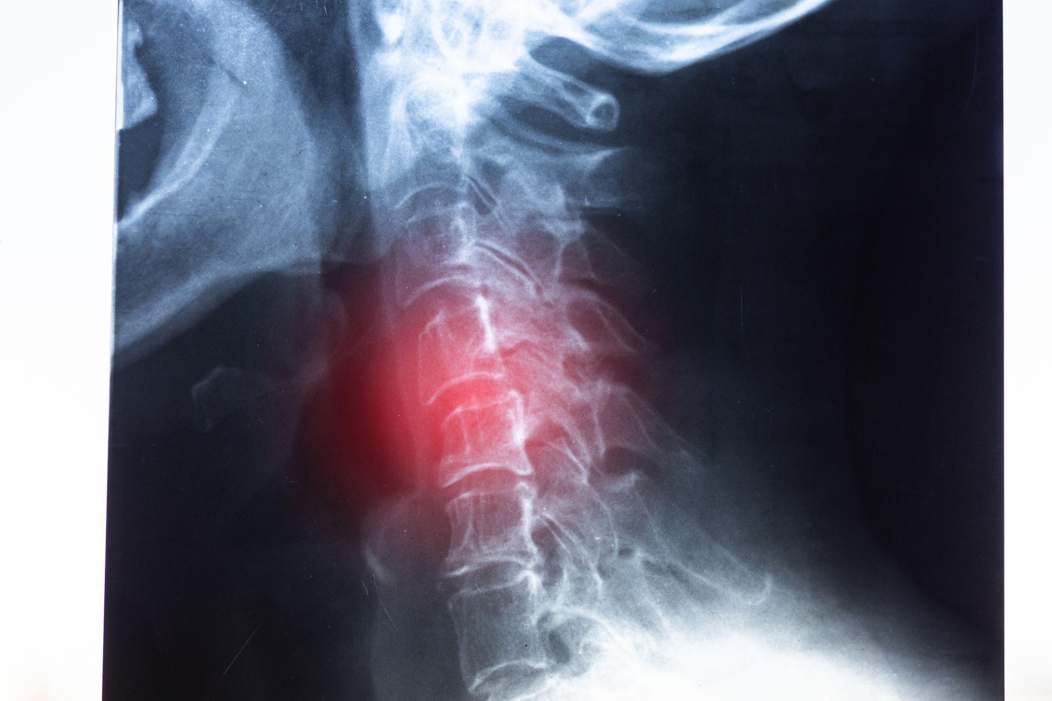 orthopaedic consultation