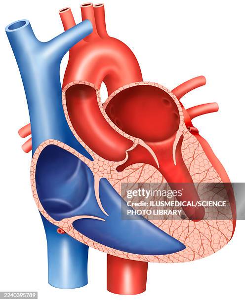 ilustraciones, imágenes clip art, dibujos animados e iconos de stock de hypertrophic cardiomyopathy, illustration - ventrículos del corazón
