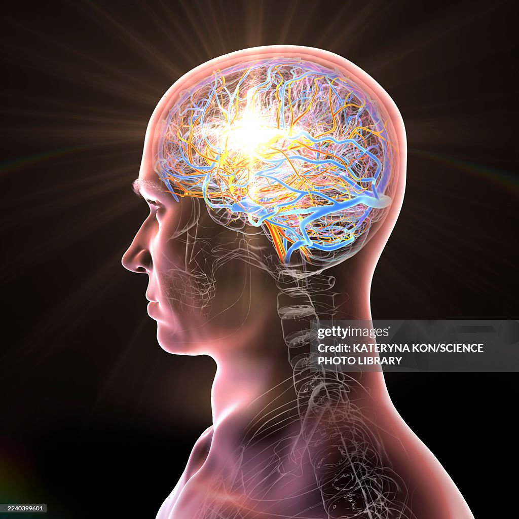 Brain stroke, conceptual illustration