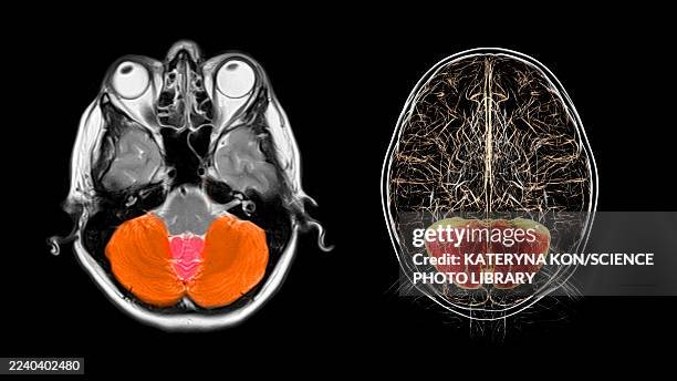 cerebellum, mri scan and illustration - neuroimaging stock illustrations