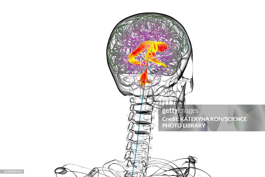 Ventricular system of the brain, illustration