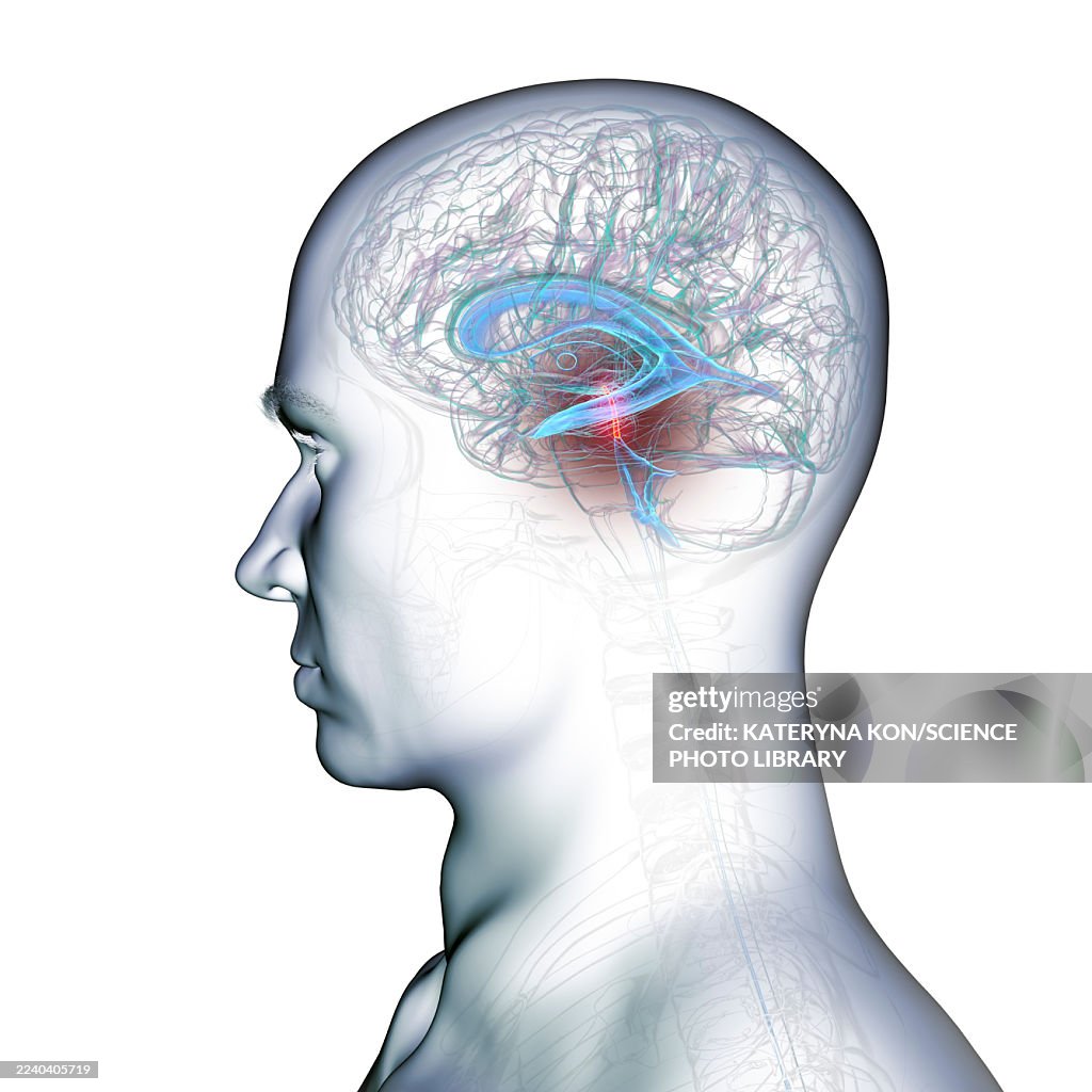 Cerebral aqueduct and ventricles, illustration