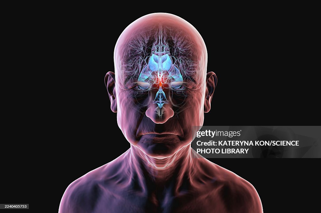 Cerebral aqueduct and ventricles, illustration