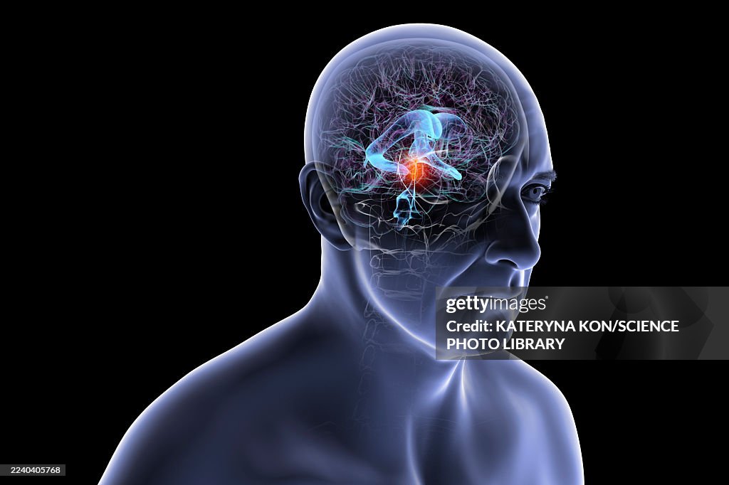 Cerebral aqueduct and ventricles, illustration