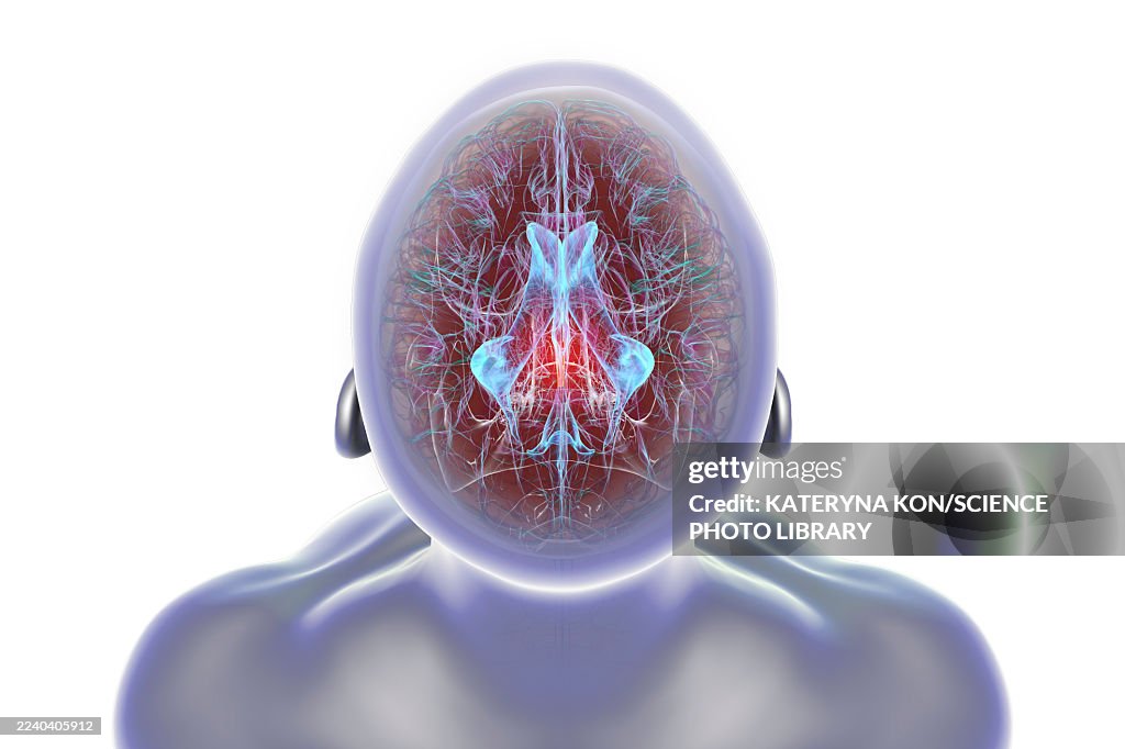 Cerebral aqueduct and ventricles, illustration