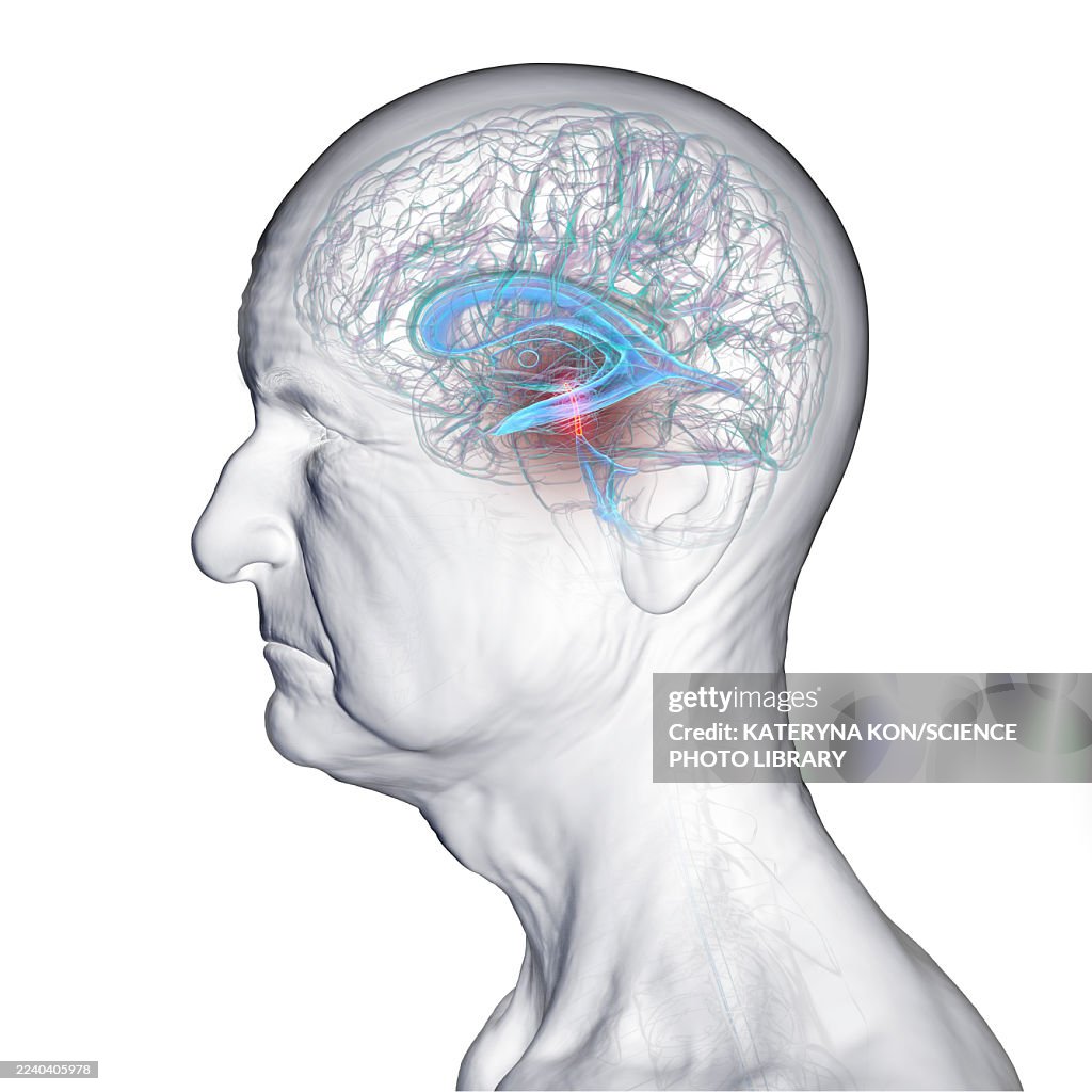 Cerebral aqueduct and ventricles, illustration