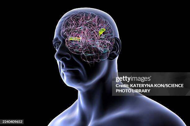 brain with highlighted transverse temporal gyri, illustration - language processing stock illustrations