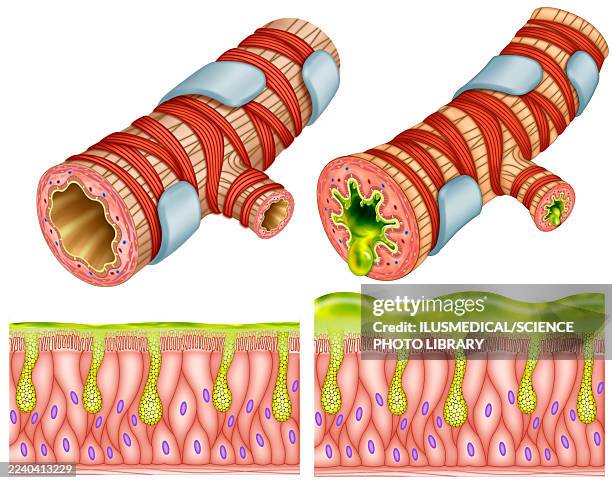 bronchial epithelial mucosa, illustration - goblet cell stock illustrations