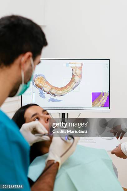 paciente femenina que se hace un escaneo de sus dientes - escaneo 3d fotografías e imágenes de stock