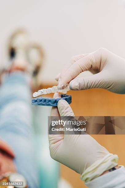 transparent dental aligners - aparelho dentário imagens e fotografias de stock