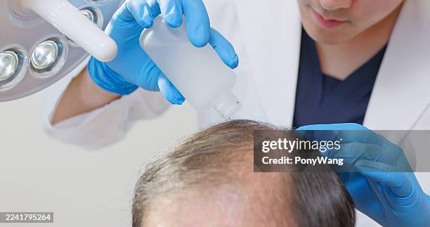 dermatologist applies hair growth - hairline polished metal stock pictures, royalty-free photos & images