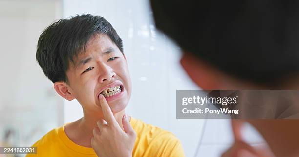 teen looks at braces in a bathroom mirror and feels unhappy - orthodontic appliance stock pictures, royalty-free photos & images