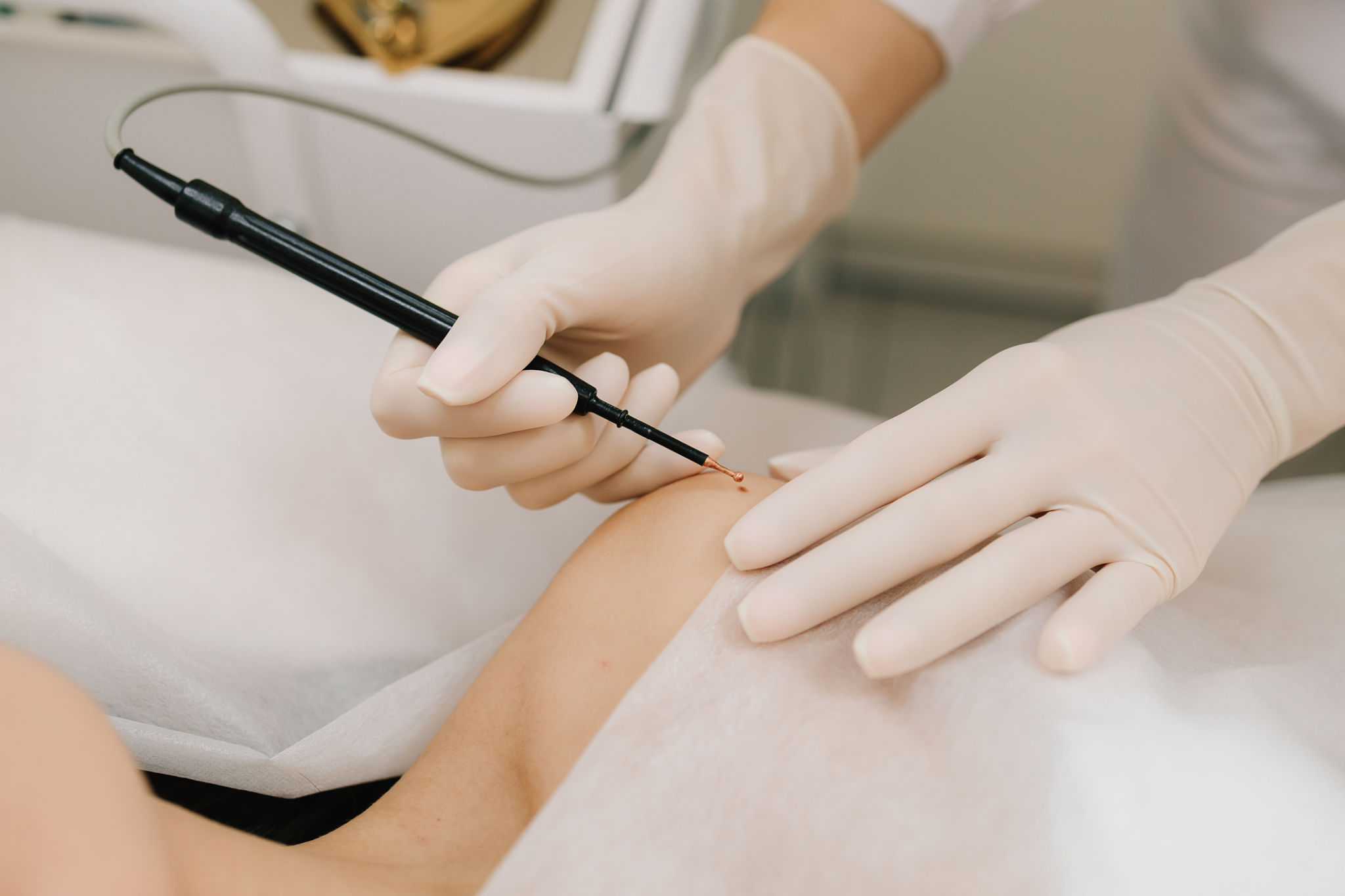 electrical stimulation