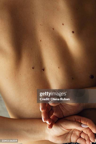 a close-up shot of a female bare back and hands. - mole stock pictures, royalty-free photos & images
