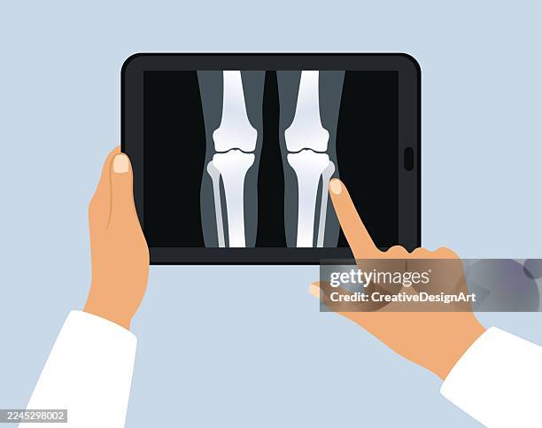 doctor examining knee x-ray image on digital tablet. digital healthcare concept - anterior cruciate ligament stock illustrations