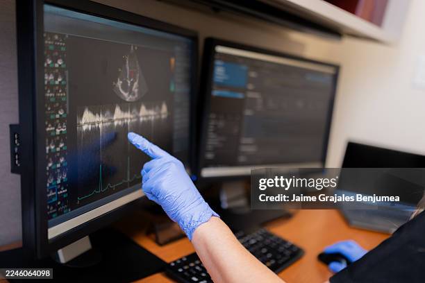 arzt analysiert die ergebnisse des echokardiogramms auf dem computermonitor - echokardiogramm stock-fotos und bilder