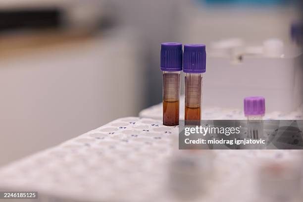 blood samples in laboratory rack - medical sample stock pictures, royalty-free photos & images
