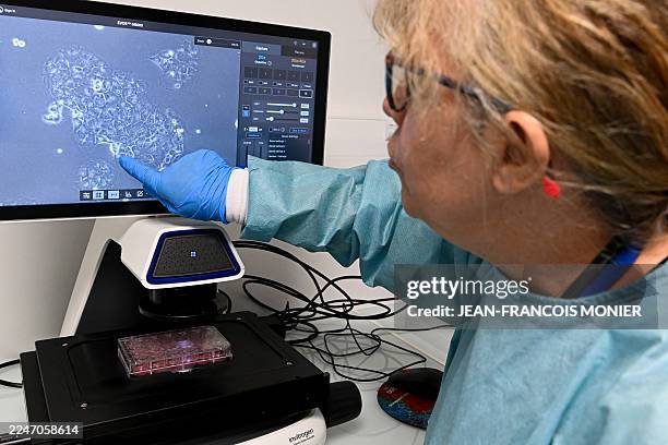 Teacher-researcher Maryvonne Ardourel points towards a pancreatic cancer cell on a micrograph displayed on a screen at the Inserm ART-RNAm laboratory...