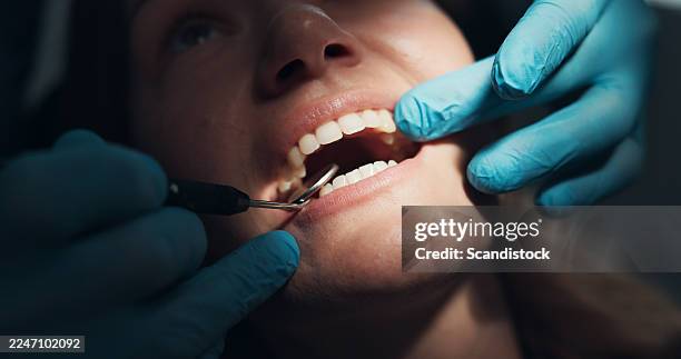 mouth, exam and hands with gloves, dental care and inspection for tooth decay, oral health and help. consultation, healthcare and dentist with tools for checkup, woman and patient with toothache - medical procedure stock pictures, royalty-free photos & images
