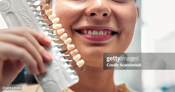 hand, teeth and dental shade scale for oral wellness, hygiene or color match for veneers. smile, tooth guide or woman in dentist clinic for medical dentures, implant or crown filling for orthodontics - enamel stock pictures, royalty-free photos & images