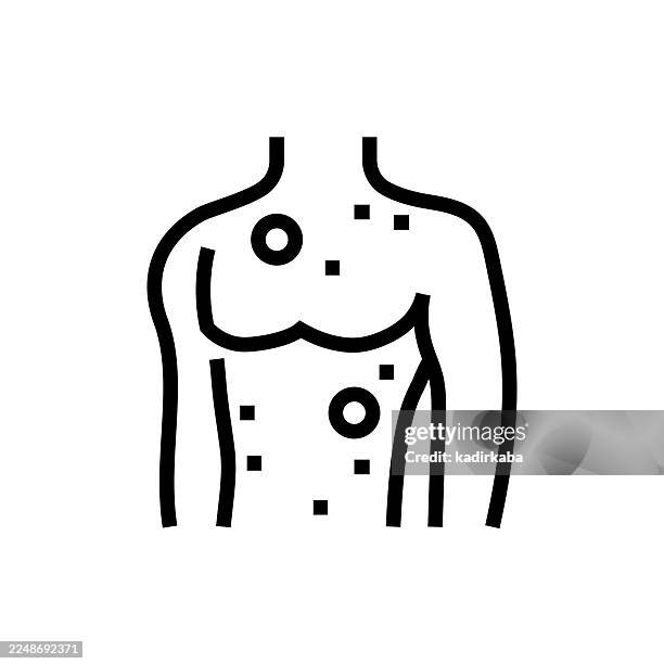 atopic dermatisis icon - psoriasis stock illustrations