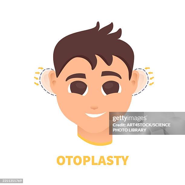 otoplasty, conceptual illustration - plastic surgery face stock illustrations