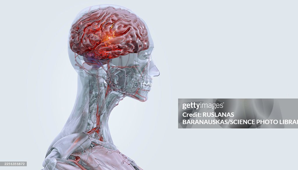 Brain disorders, conceptual illustration
