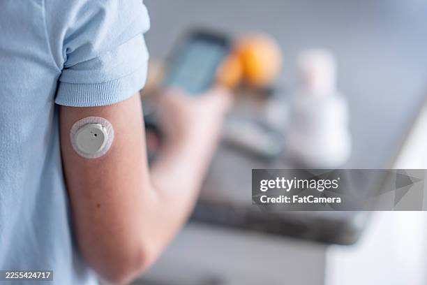 gros plan du bras avec un patch de glucose dans un cadre de soins de santé pour la gestion du diabète - capteur photos et images de collection