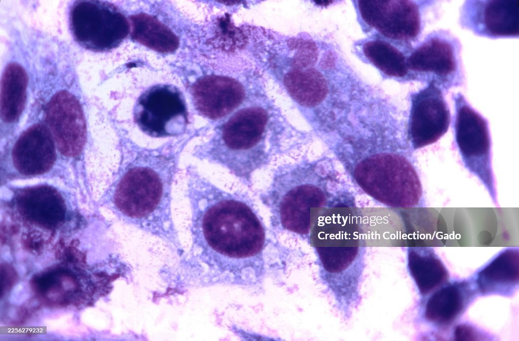 Giemsa-Stained Hela Cell Monolayer