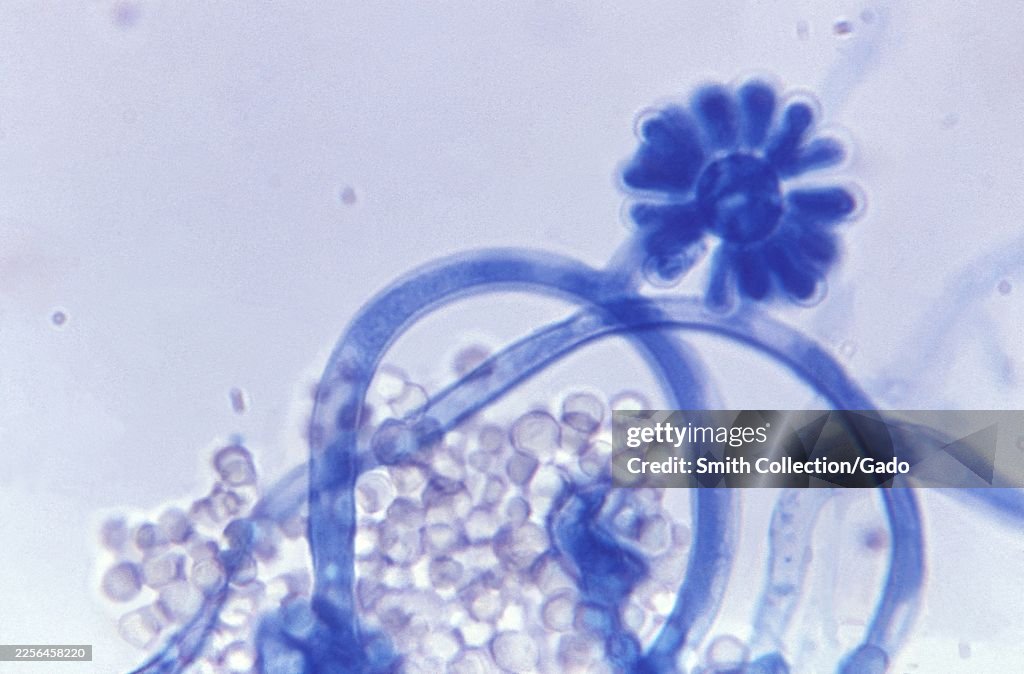 Syncephalastrum Sp. Fungus Micrograph