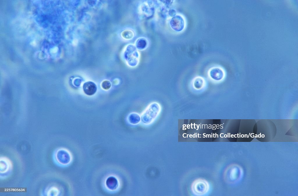 Saccharomyces Cerevisiae Yeast Cells 900X