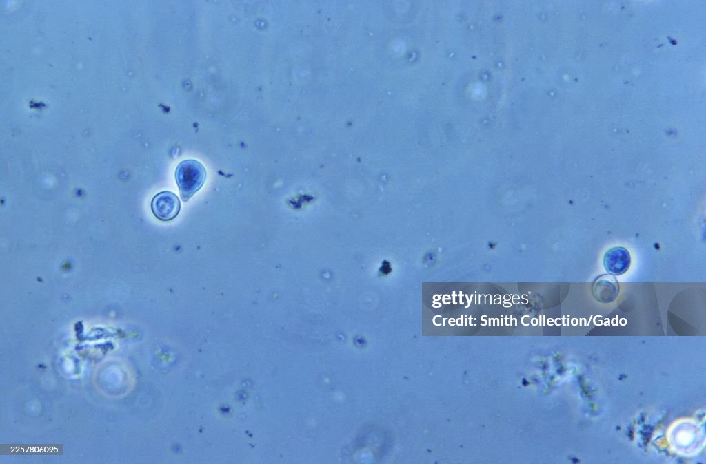 Blastomyces Dermatitidis Yeast Photomicrograph