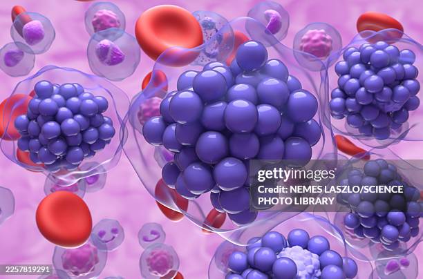 diffuse large b-cell lymphoma, illustration - lymphoblastic leukemia stock illustrations