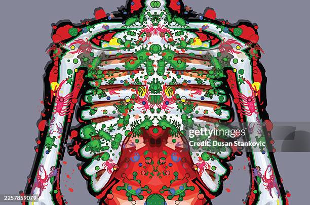 ilustrações de stock, clip art, desenhos animados e ícones de bacterial pneumonia - organismo acidófilo