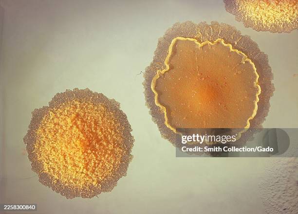 Petri dish culture plate showing three Mycobacterium marinum colonies on Middlebrook 7H10 agar, 1965. The right-of-center colony has a smooth...
