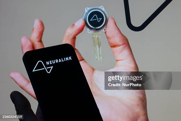 Neuralink - Photo Illustration Neuralink - Photo Illustration