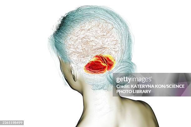 stockillustraties, clipart, cartoons en iconen met brain with highlighted cerebellum, illustration - multiple sclerose
