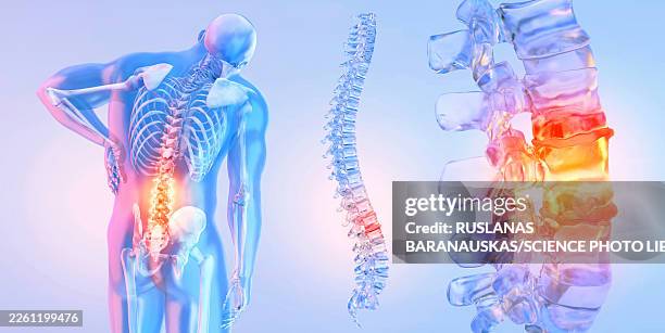 back pain, conceptual illustration - osteoporose stock-grafiken, -clipart, -cartoons und -symbole