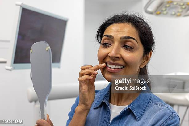 they look fine - implante imagens e fotografias de stock