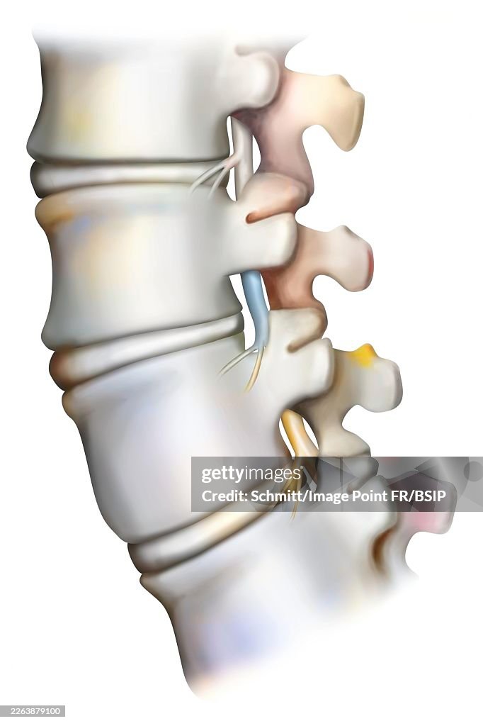 Lumbar vertebra