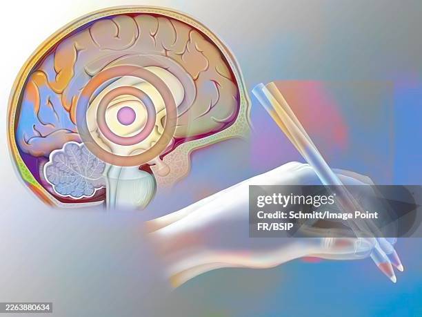 parkinson's disease - profile stock illustrations