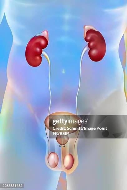 bladder cancer - kidney stone illustration stock illustrations