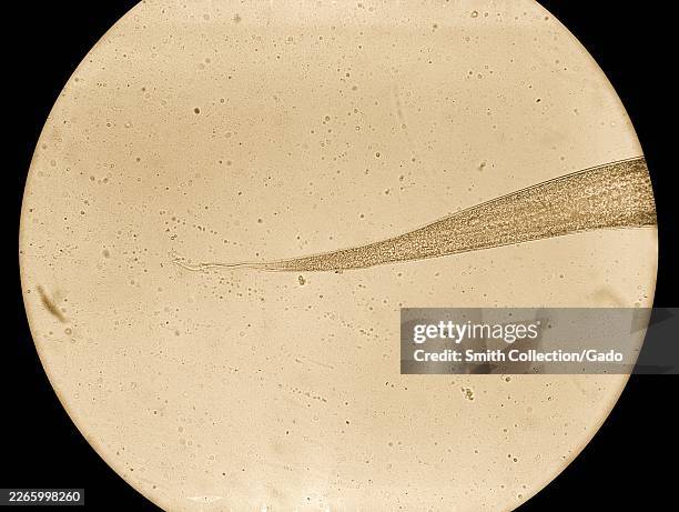 Pinworm Head Wing 151 Pinworm Stock Photos, High-Res Pictures, and Images - Getty Images